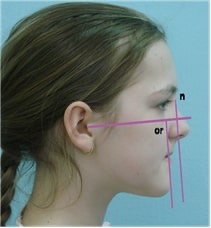 89. Тип профиля по методу шварц