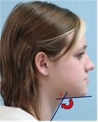 91. На фото представлен угол