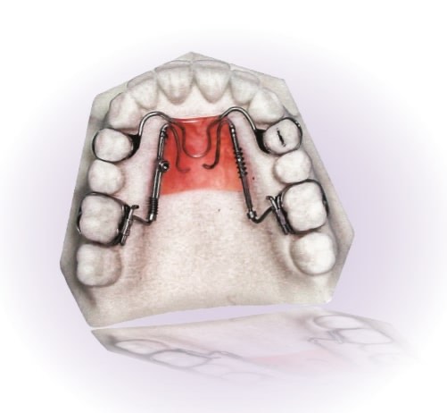 325. Аппарат по месту расположения относится к