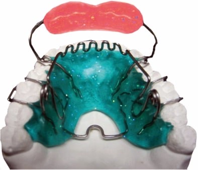 387. На рисунке представлен