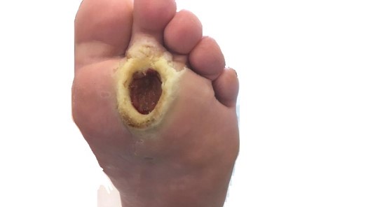 2440. Данный вид раны характерен для