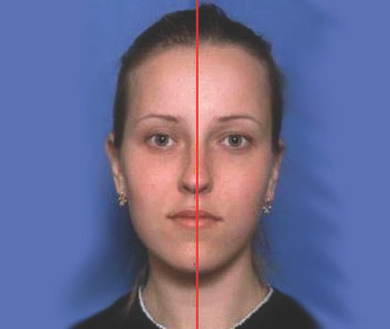 1431. Линия симметрии лица проводится через точки