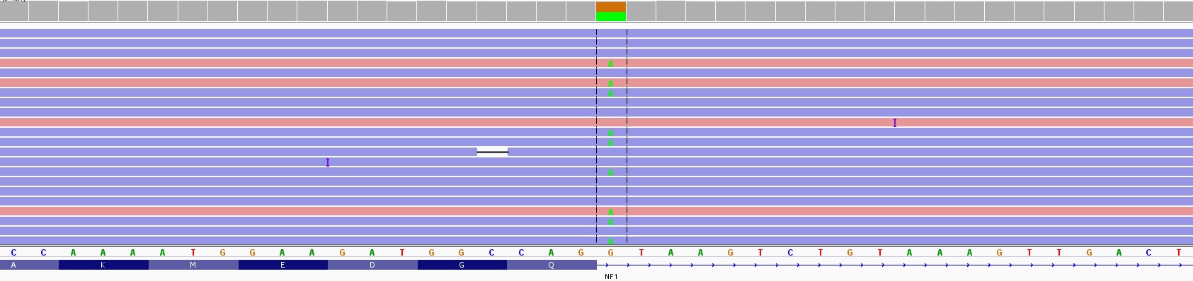 1727. На скриншоте геномного браузера показано выравнивание на референсный геном человека прочтений, полученных методом