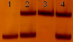 1737. На фотографии представлен анализ метилирования промотора snrpn при проведении диагностики синдромов прадера-вилли и ангельмана. дорожки «2,4» верх – амплификация неметилированных, «2,4» низ – метилированных аллелей здоровых доноров. в дорожке «3» зафиксирована ДНК