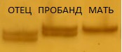1761. Пример амплификации маркера d15s11 при проведении диагностики синдромов прадера-вилли и ангельмана методом микросателлитного анализа в дорожках «отец», «пробанд», «мать» представлены продукты амплификации ДНК изучаемого локуса соответствующих членов семьи. у пробанда