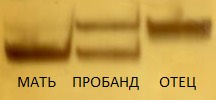 1767. Пример амплификации маркера d22s941 при проведении диагностики синдромов из группы «catch 22» методом микросателлитного анализа в дорожках «отец», «пробанд», «мать» представлены продукты амплификации ДНК изучаемого локуса соответствующих членов семьи. у пробанда