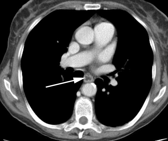2853. На представленном изображении стрелка указывает на