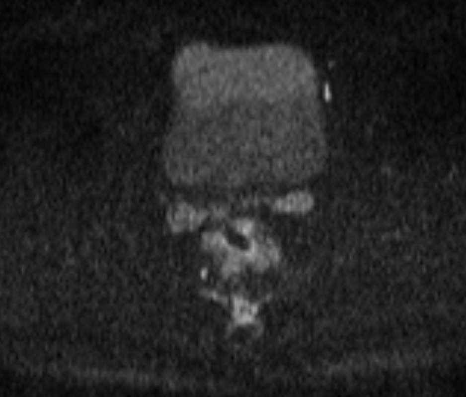 2899. Представленные мр-томограммы органов малого таза относят к