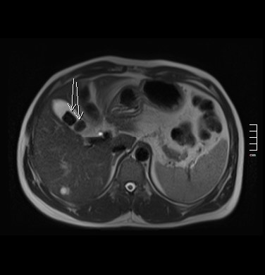 2908. Стрелками указаны