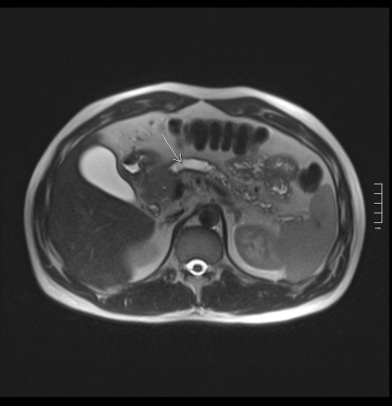 2912. Структура, указанная стрелкой, является
