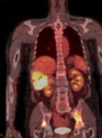 1958. Методом исследования, которому соответствует представленная томограмма, является