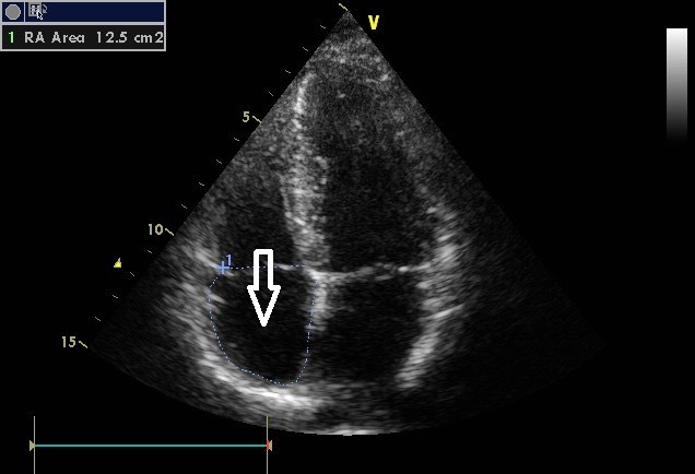 2700. Структурой, указанной стрелкой на сонограмме изображения, является