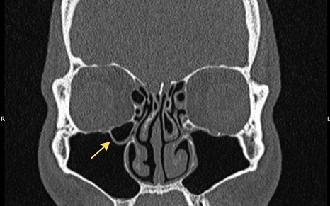2397. Анатомическая структура, отмеченная на снимке, является