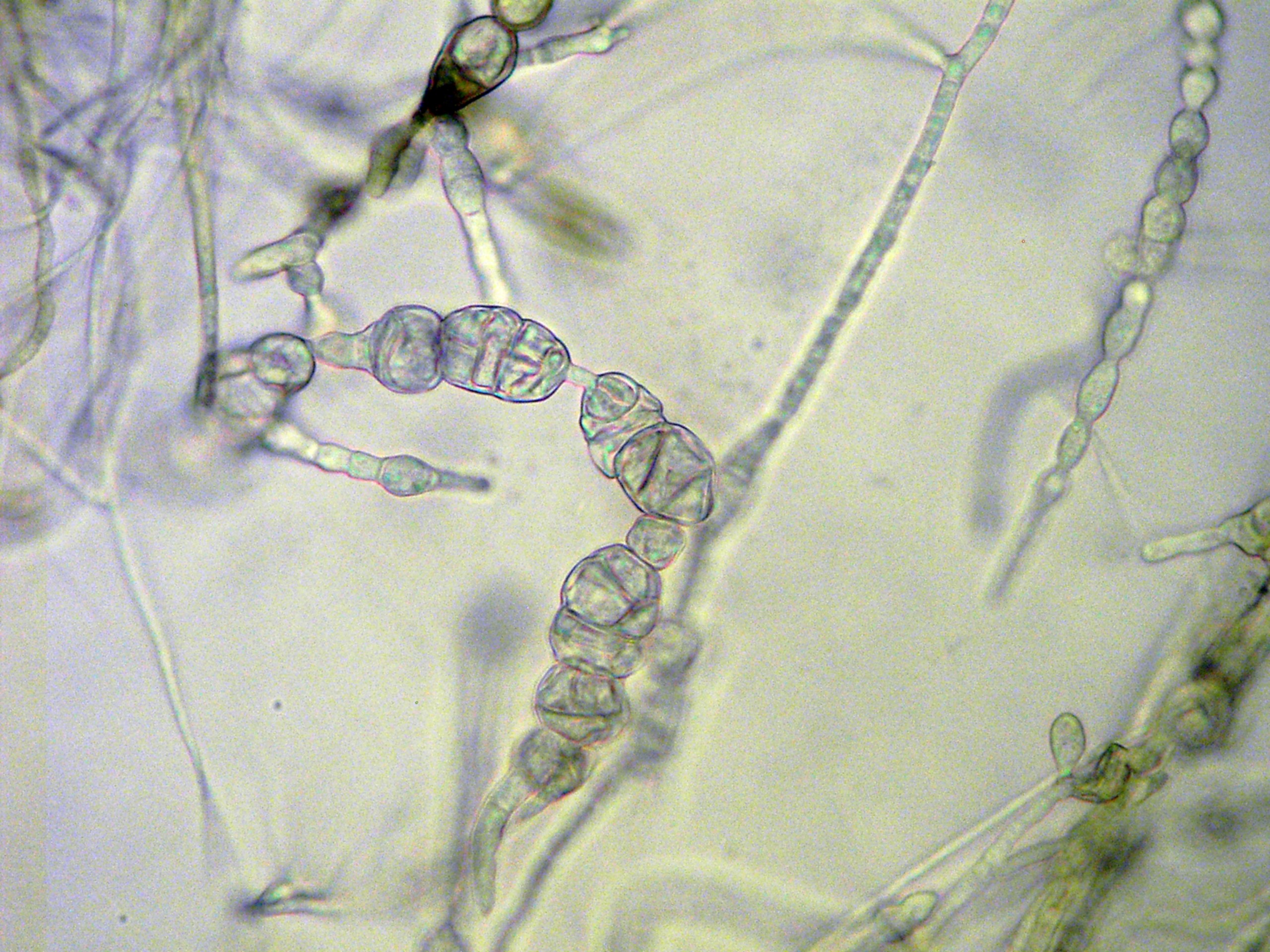 2000. Компактные элементы строения мицелиального гриба, которые отображены на снимке, называют