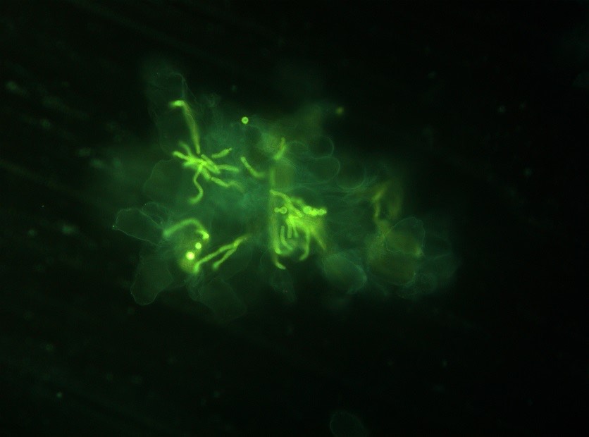 2049. В препарате соскоба кожных чешуек обнаружена тканевая форма гриба, характерная для представителей рода