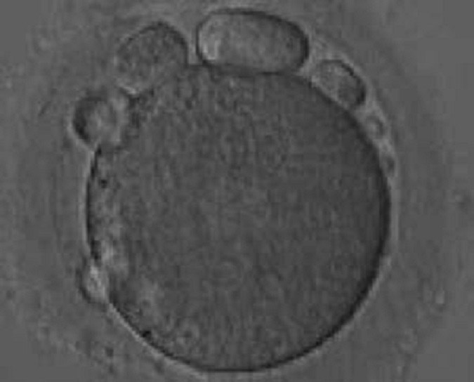 765. На рисунке представлен ооцит