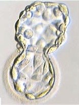 797. Особенностью бластоцисты является