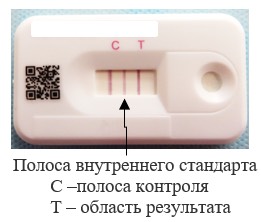 1531. Данный иммунохроматографический тест на наличие простатспецифического антигена означает, что