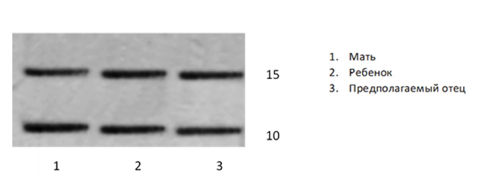 3558. По представленным результатам гель-электрофореза отцовским аллелем в генотипе ребенка является