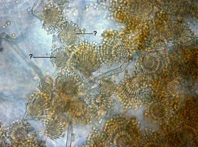 2047. На микроснимке препарата из культуры aspergillus tamarii знаком «?» отмечены