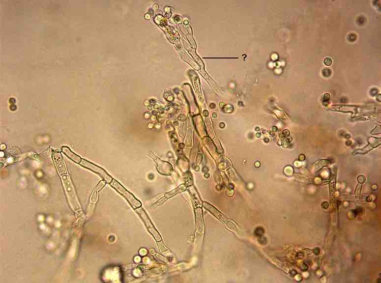 2028. На микроснимке препарата из культуры penicillium sp. знаком «?» отмечена